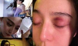 女艺人爆料当年受伤视频,那段难忘的受伤经历